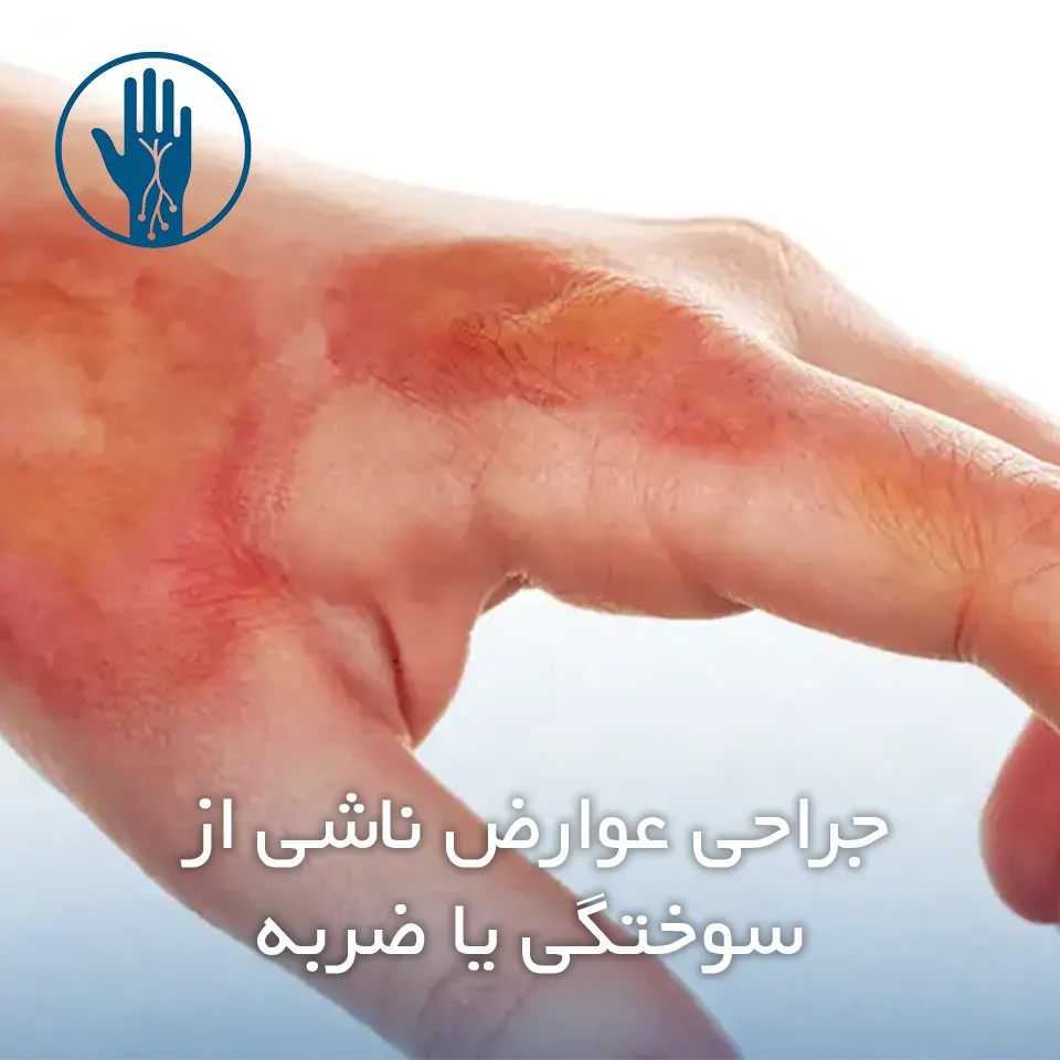 جراحی عوارض ناشی از سوختگی یا ضربه​