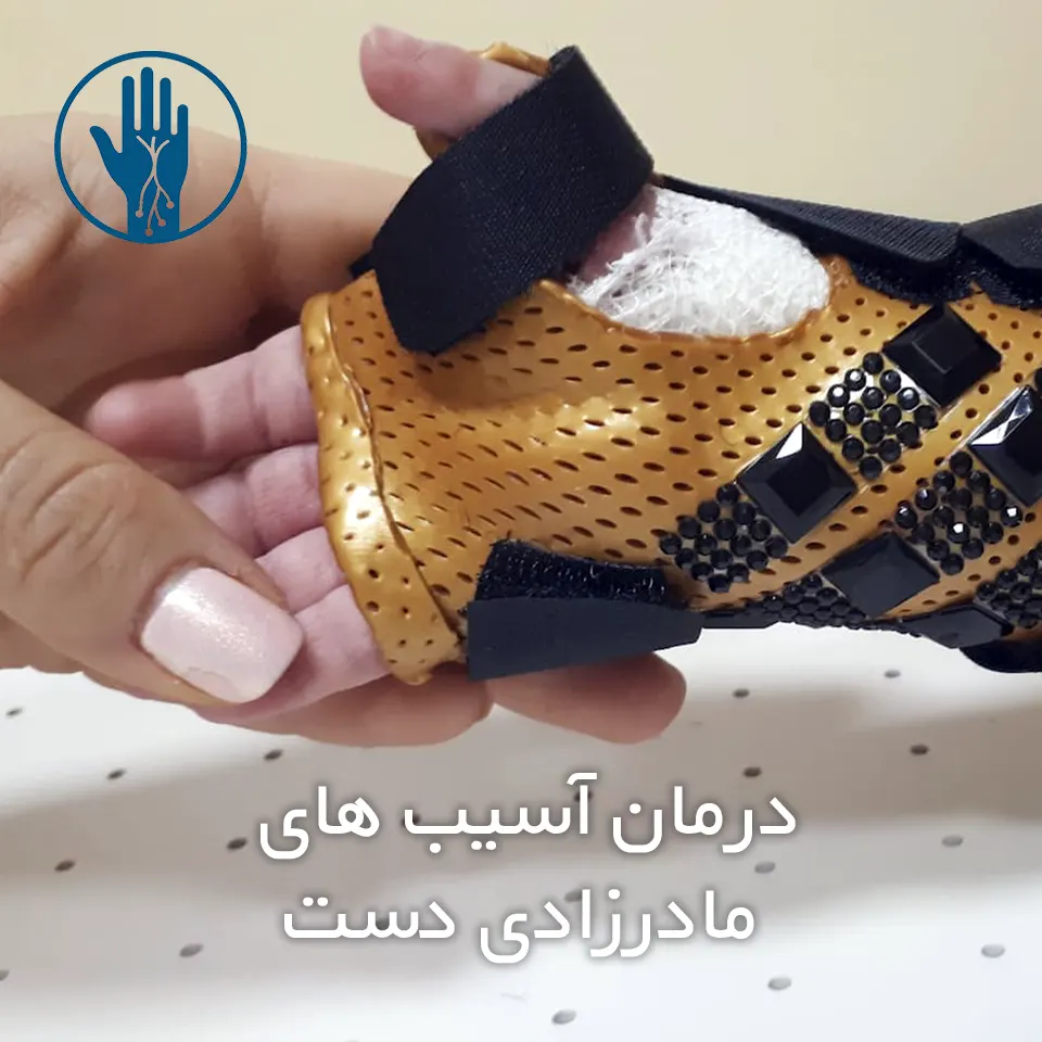 درمان‌ آسیب‌ های مادرزادی دست​​