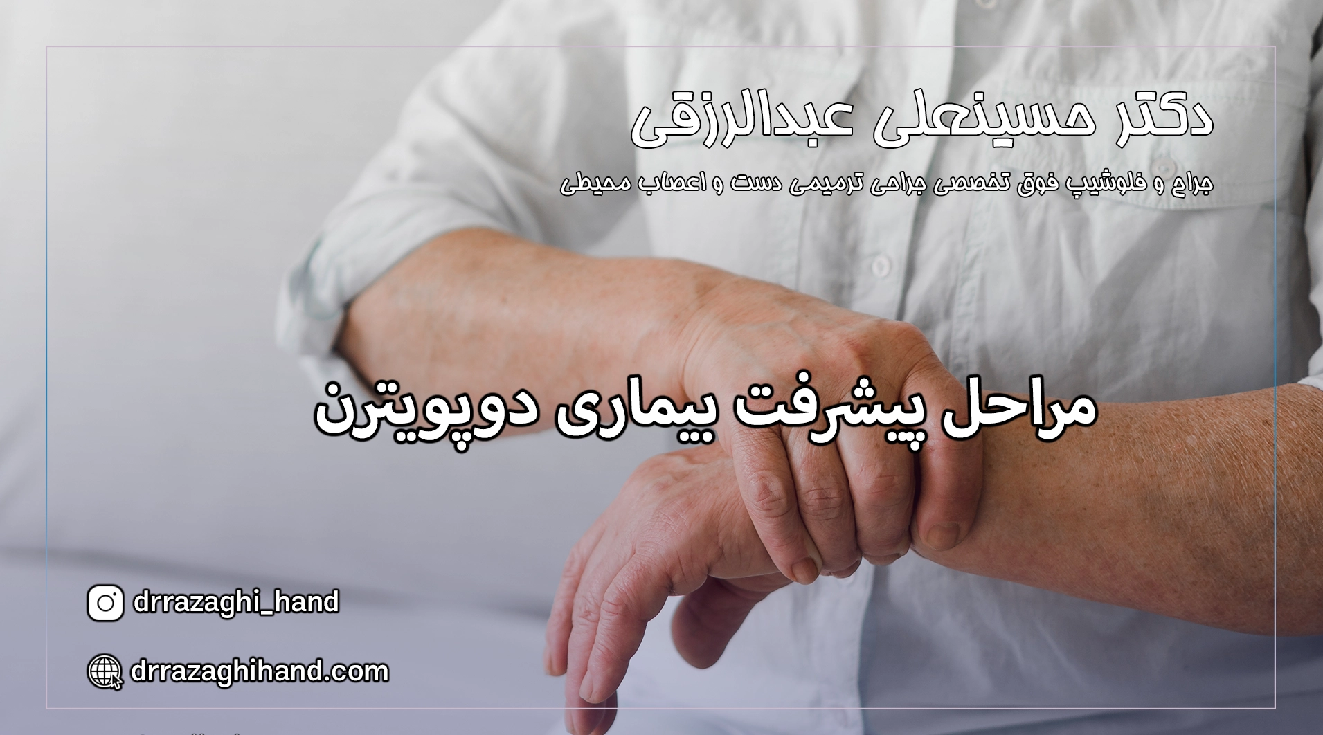 مراحل پیشرفت بیماری دوپویترن