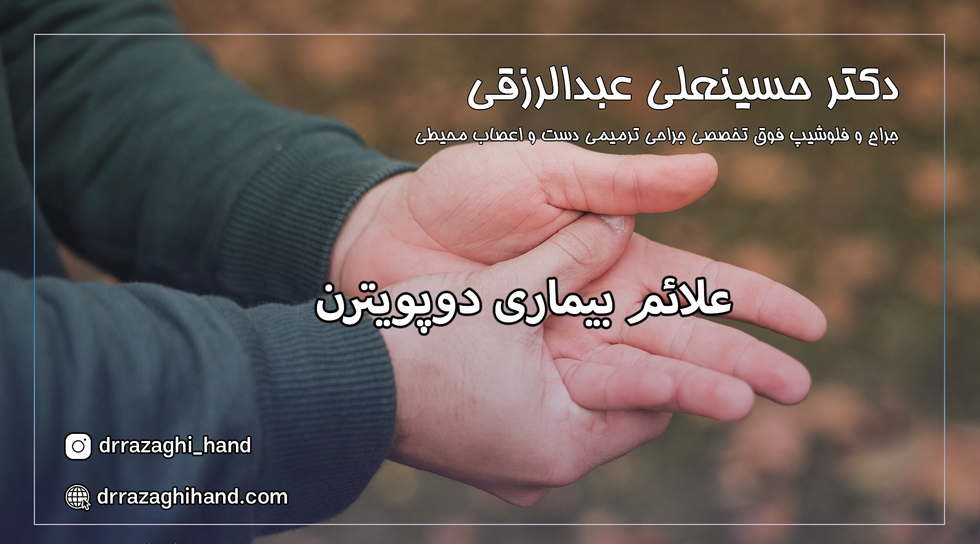 علائم بیماری دوپویترن