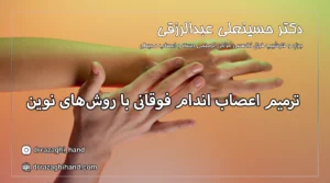 ترمیم اعصاب اندام فوقانی