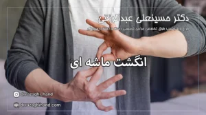 انگشت ماشه ای