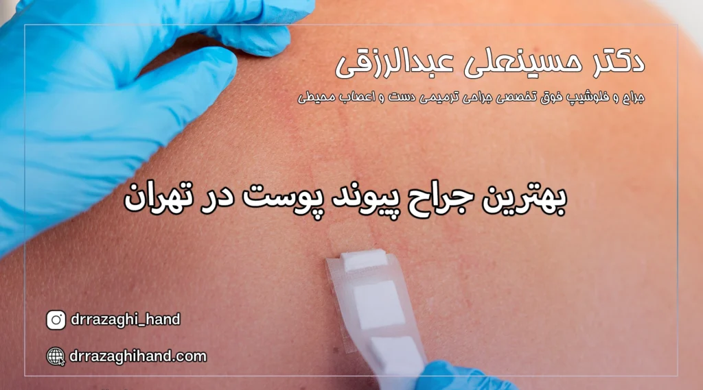 بهترین جراح پیوند پوست در تهران