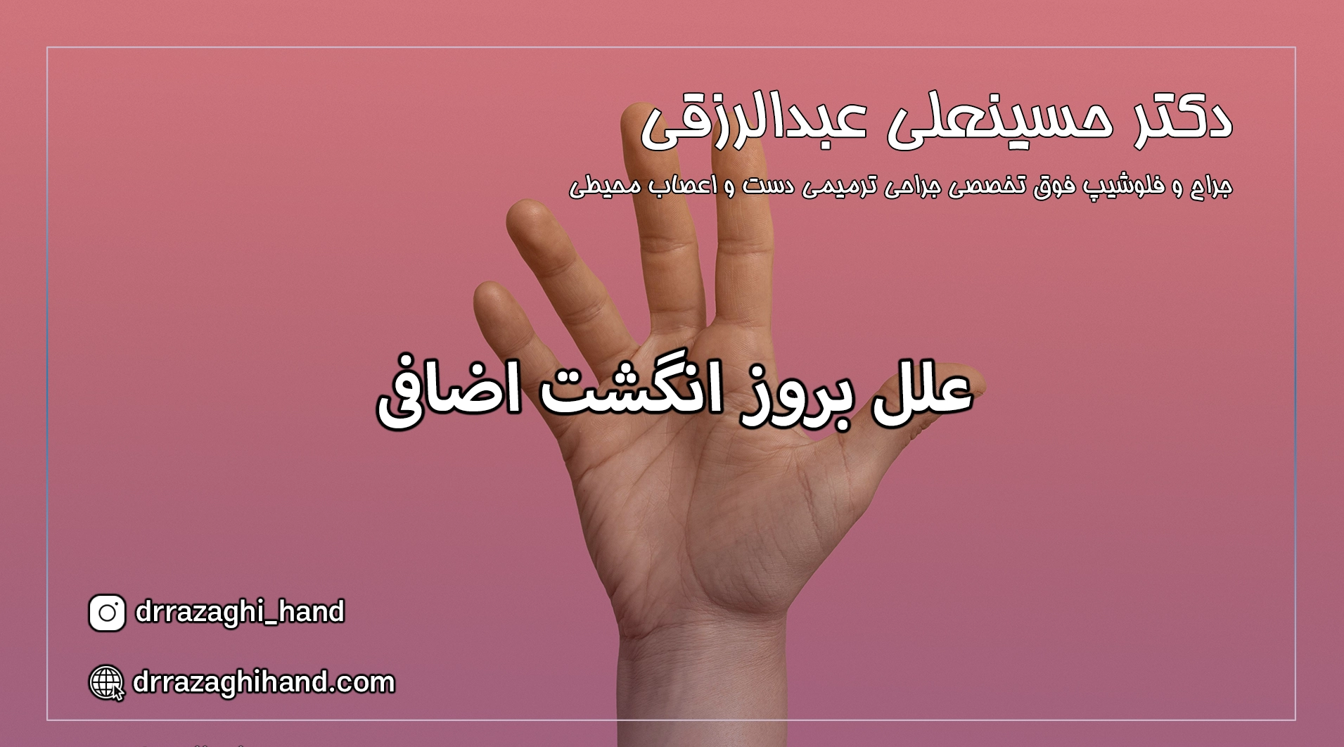 درمان انگشت اضافی