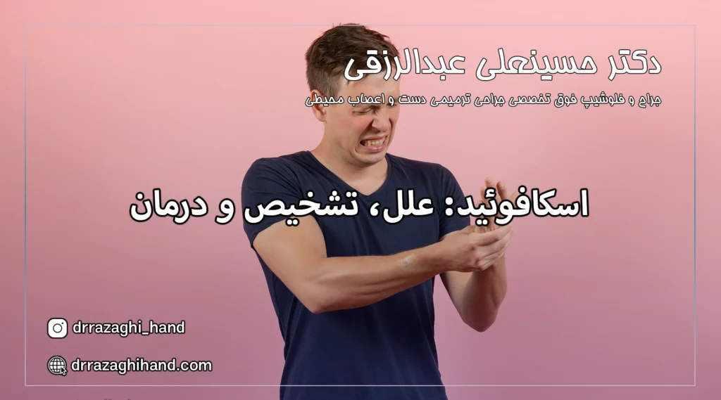 اسکافوئید: علل، تشخیص و درمان