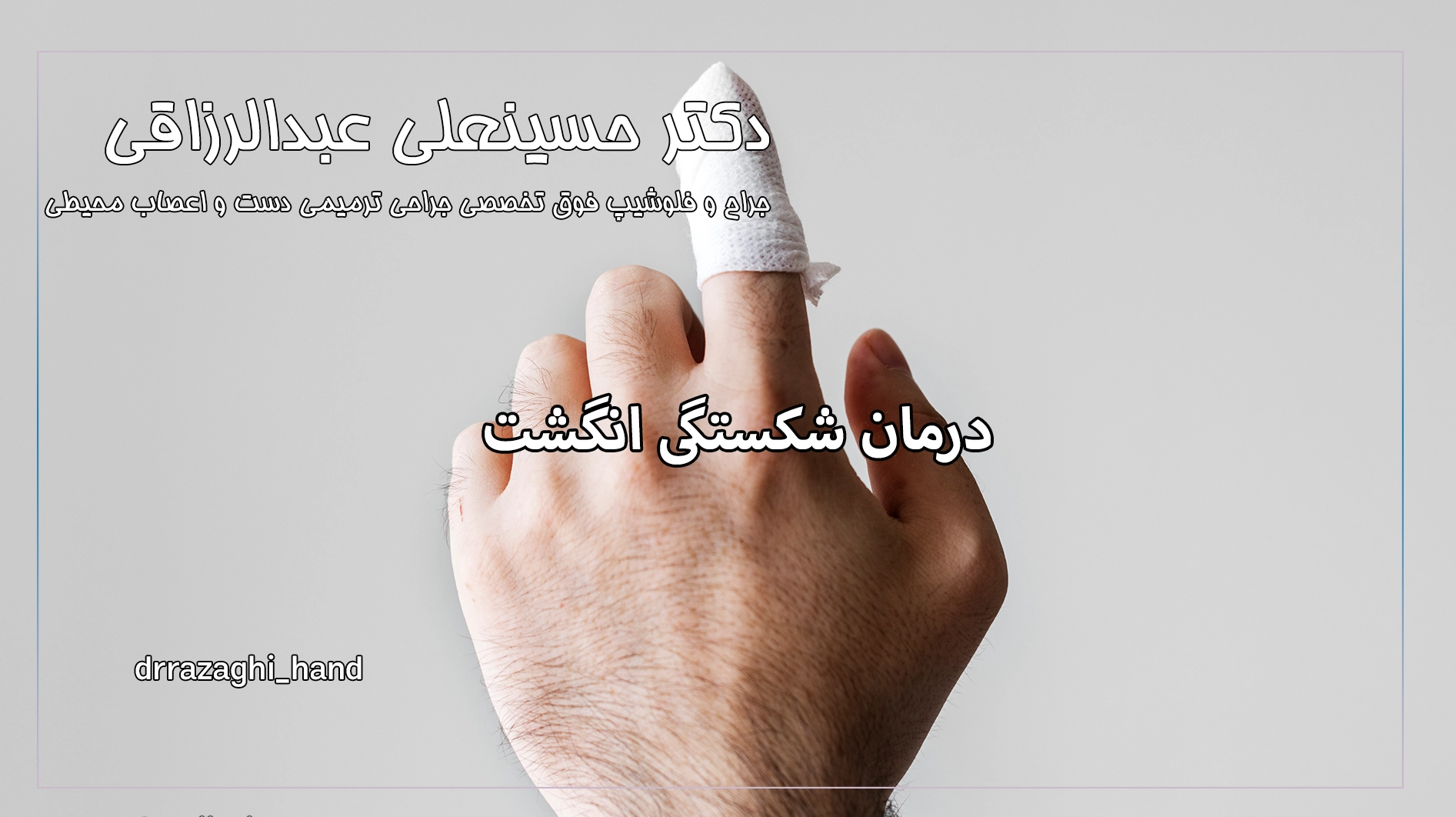 درمان شکستگی انگشت