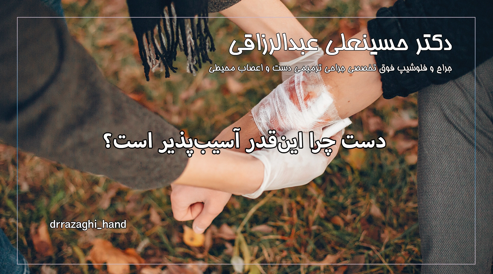 دست چرا اینقدر آسیبپذیر است؟